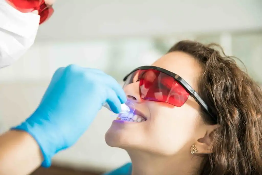 Cosa non mangiare dopo lo sbiancamento dei denti: guida completa 9 Cosa non mangiare dopo lo sbiancamento dei denti