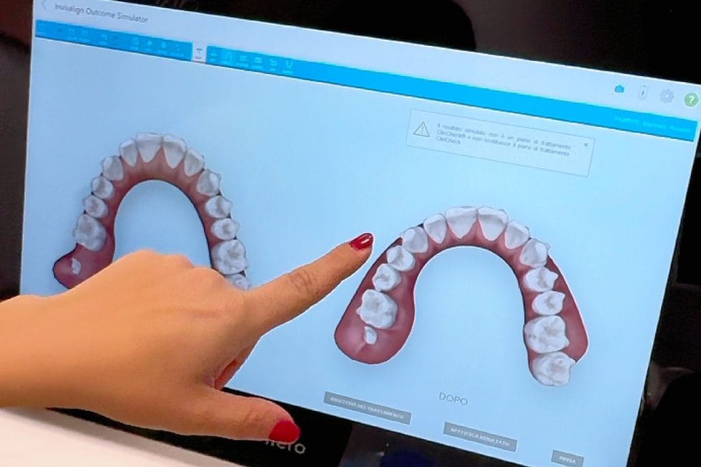 Ortodonzia 18 previsualizzazione sorriso
