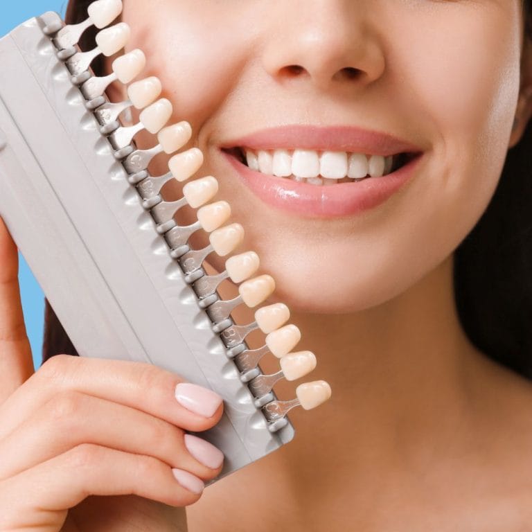 che cosa sono le faccette dentali che cosa sono le faccette dentali