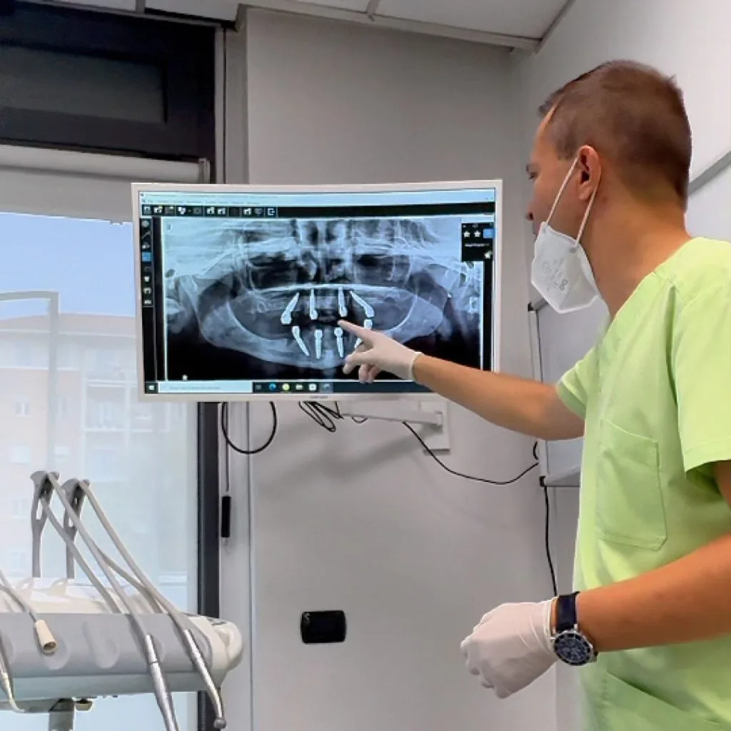 Home 42 chi ha osteoporosi può fare impianti dentali