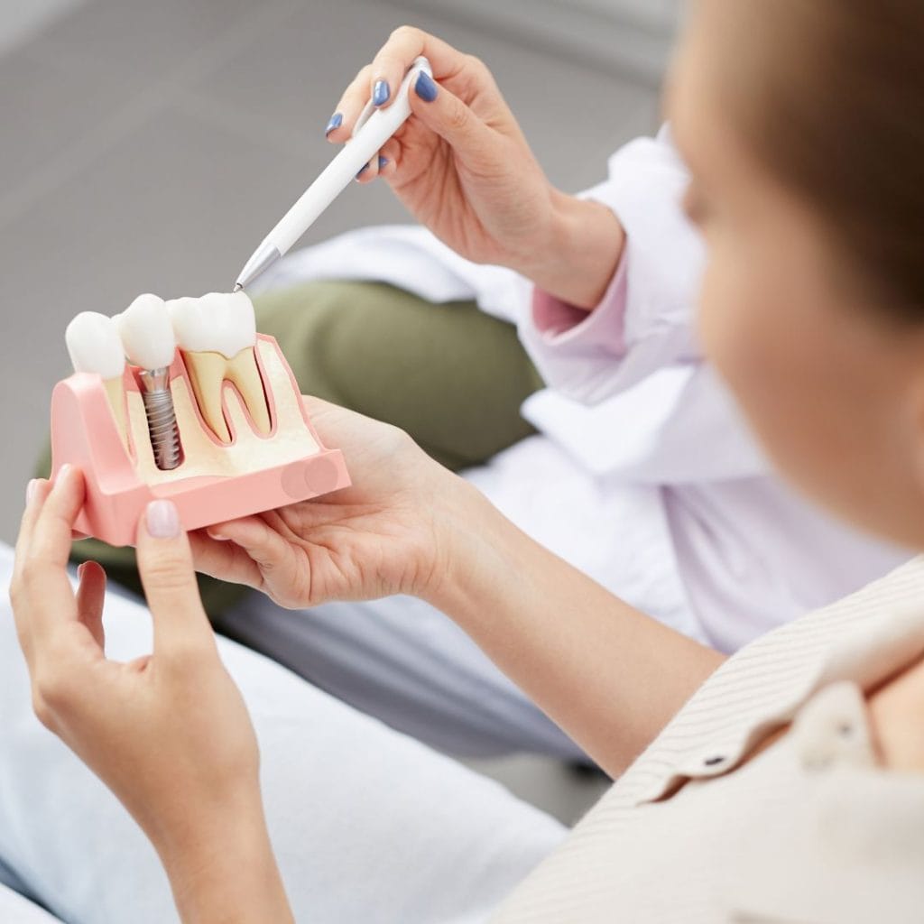 È doloroso l’impianto dentale? Guida Completa 4 è doloroso l'impianto dentale