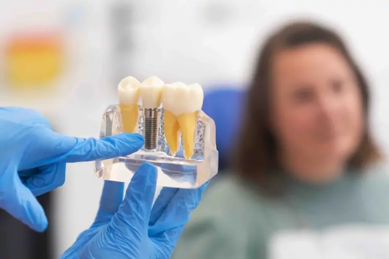 Gonfiore dopo impianto dentale Gonfiore dopo impianto dentale